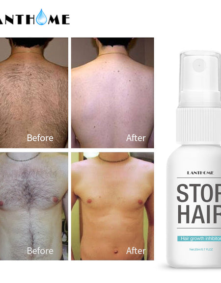 Best Hair Growth Inhibitor Spray