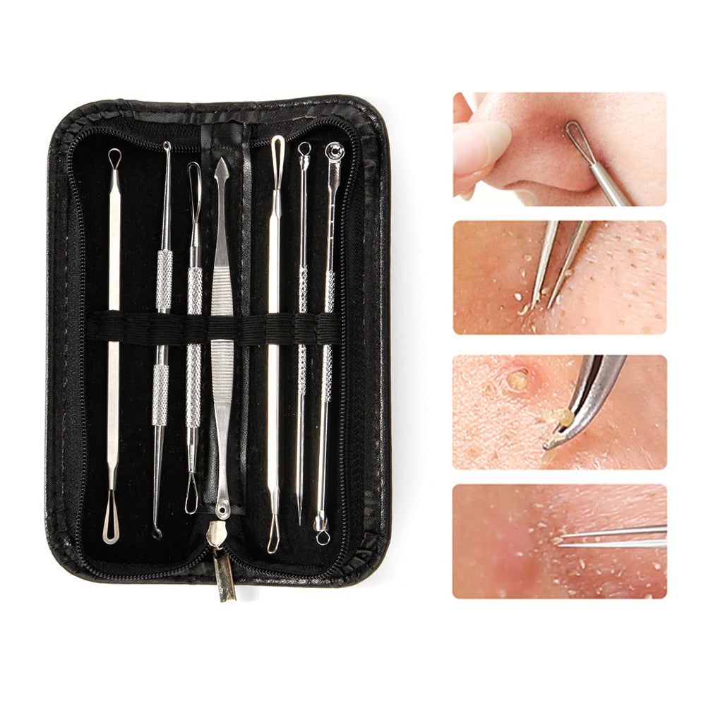 Best Blackhead Remover Tools